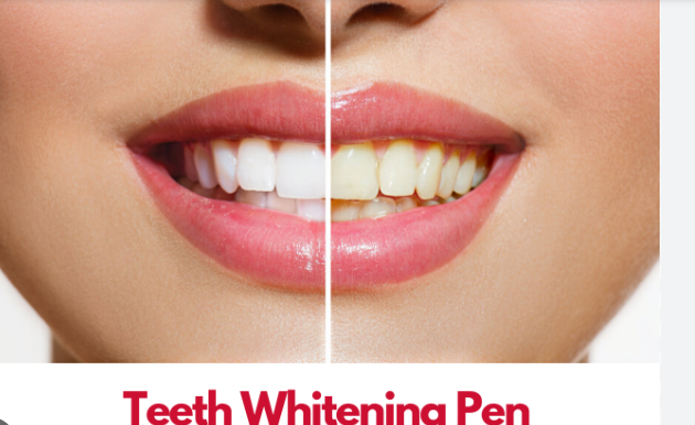 How to Choose the Best Teeth Whitening Pen for Your Needs